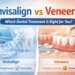 invisalign or veneers